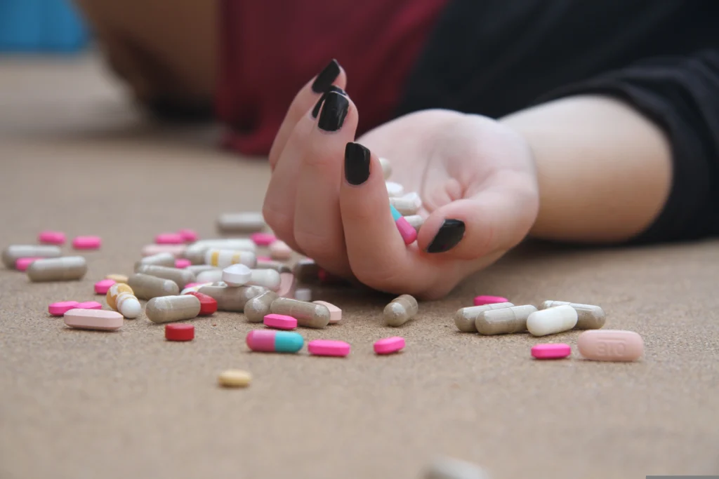 Major Depressive Disorder (MDD)